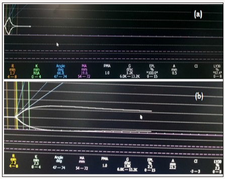 Click here to view Large Scheme 1 Lupinepublishers-openaccess-Research-Reviews