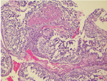 Click here to view Large Figure 1 Lupinepublishers-openaccess-Research-Reviews