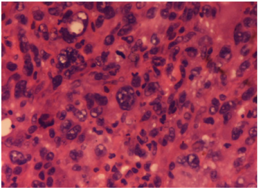 Click here to view Large Figure 2 Lupinepublishers-openaccess-Research-Reviews