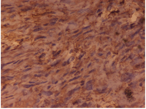 Click here to view Large Figure 3 Lupinepublishers-openaccess-Research-Reviews