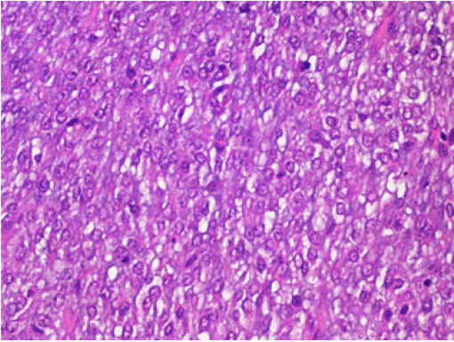 Click here to view Large Figure 4 Lupinepublishers-openaccess-Research-Reviews