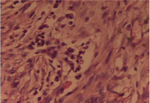 Click here to view Large Figure 5 Lupinepublishers-openaccess-Research-Reviews