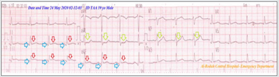 Click here to view Large Figure 1 Lupinepublishers-openaccess-Research-Reviews