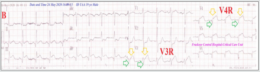 Click here to view Large Figure 3 Lupinepublishers-openaccess-Research-Reviews