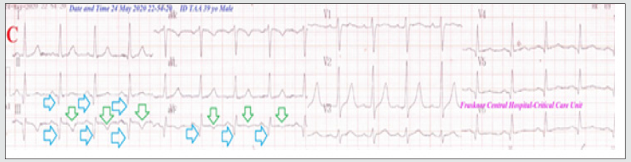 Click here to view Large Figure 4 Lupinepublishers-openaccess-Research-Reviews