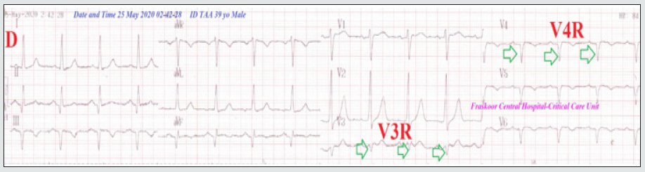 Click here to view Large Figure 5 Lupinepublishers-openaccess-Research-Reviews