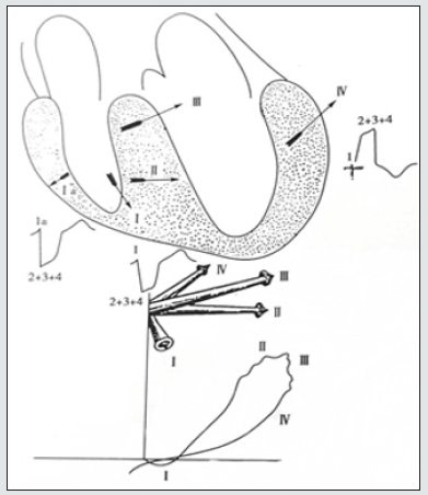 Click here to view Large Figure 2 Lupinepublishers-openaccess-Research-Reviews