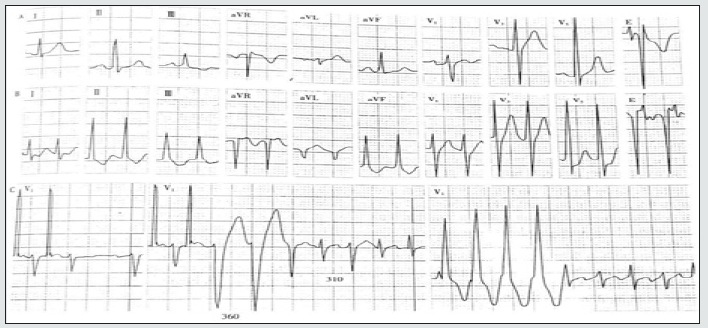 Click here to view Large Figure 3 Lupinepublishers-openaccess-Research-Reviews
