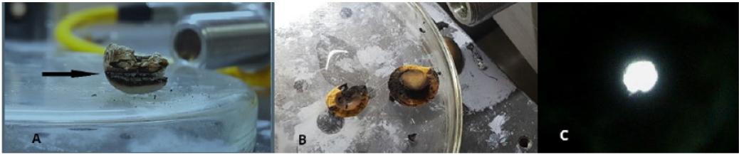 Click here to view Large Figure 1 lupinepublishers-openaccess-journal-urology-nephrology